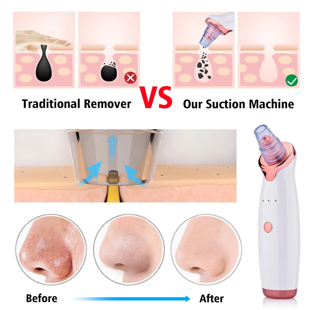 Electric Facial Blackhead Remover Vacuum Pore Cleaner Acne Cleanser Black Spots Removal Face Nose Deep Cleaning tools beautifina.com